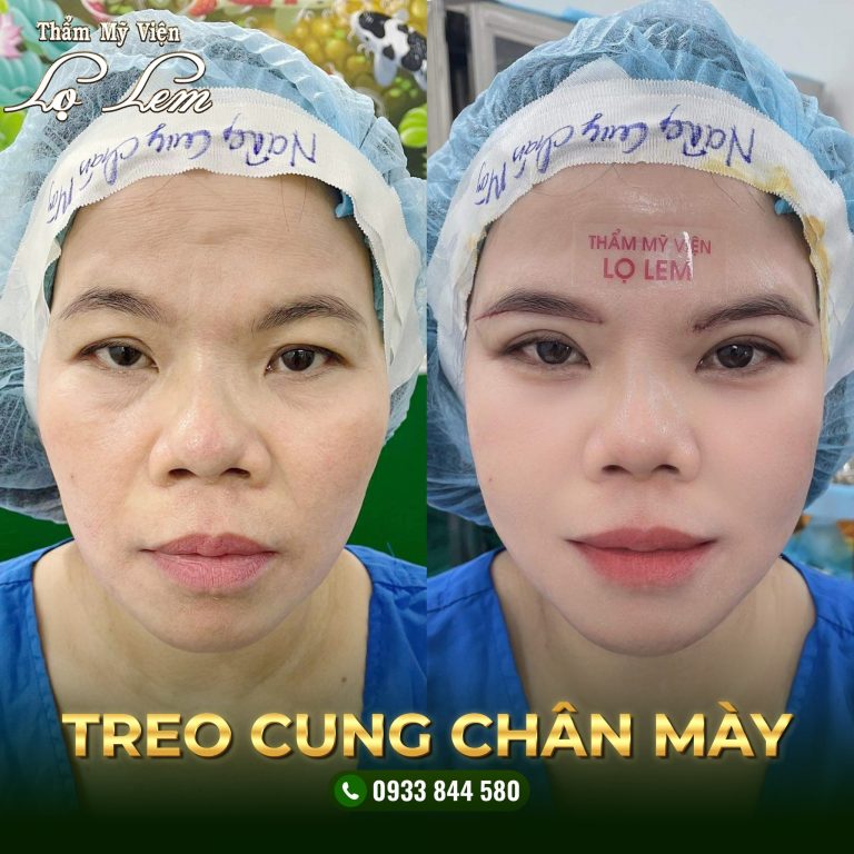 Treo cung chân mày tại Lọ lem
