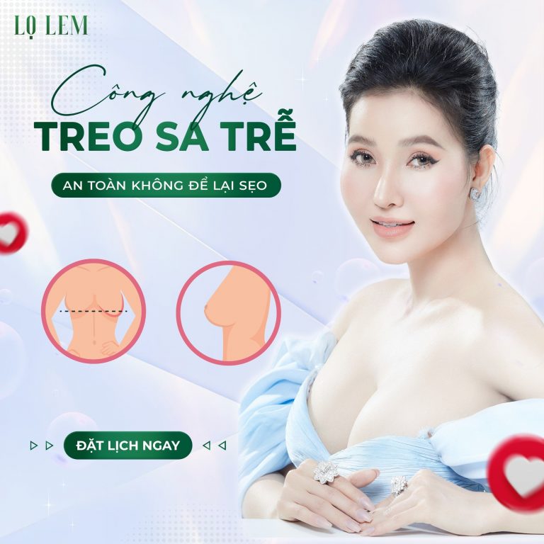 Treo ngực sa trễ tại Lọ Lem