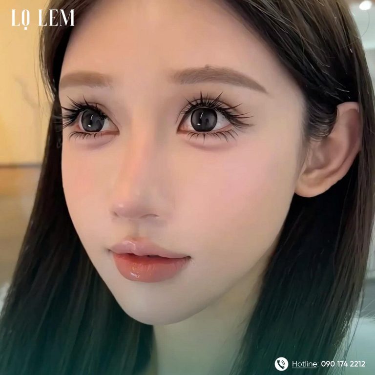 Khách hàng Căt bọng mắt dưới tại Lọ Lem