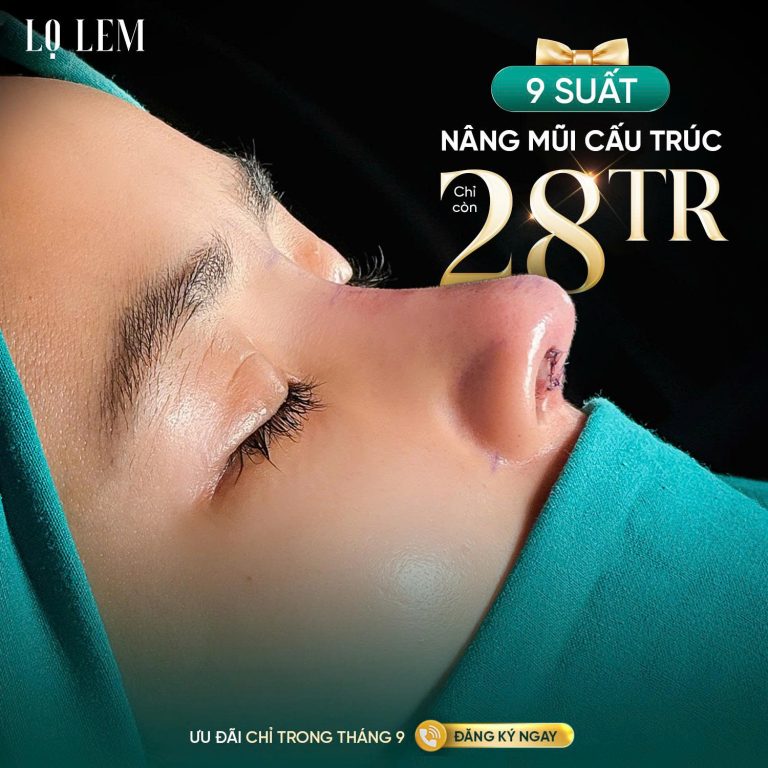 Nâng Mũi Cấu Trúc Trung Hoa chỉ còn 28 Triệu tại Lọ Lem