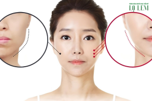 Gọt Cằm Bao Nhiêu Tiền? Bảng Giá Tại Top 6 Địa Chỉ Uy Tín