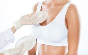 Tiêu chí nâng ngựa an toàn. Top 6 địa chỉ nâng ngực uy tín