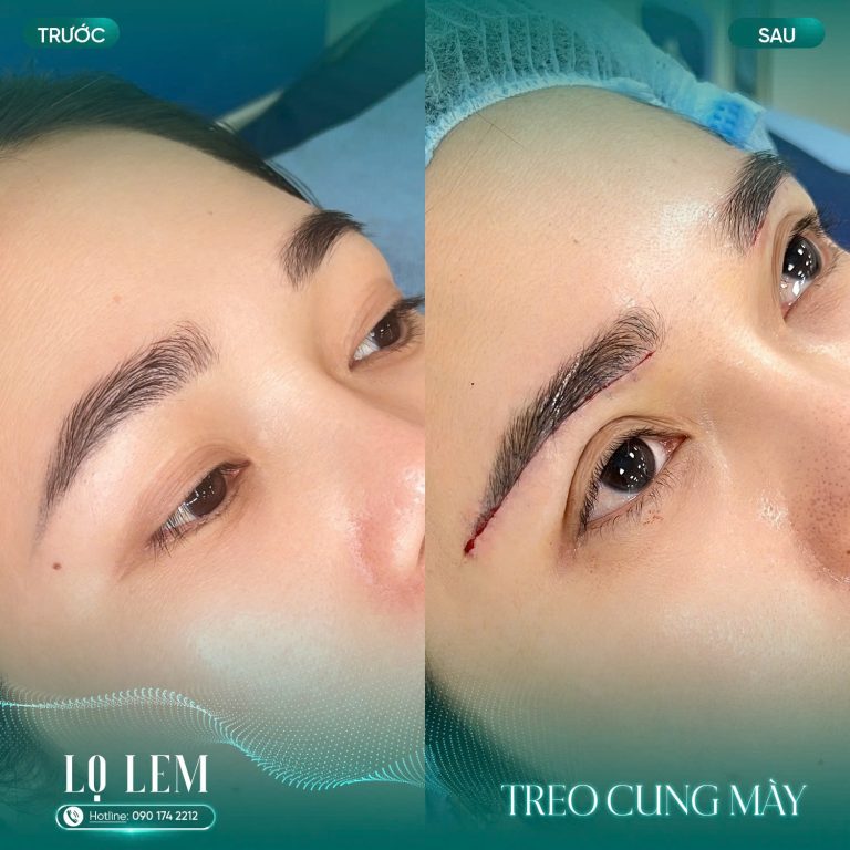 treo cung chân mày tại Lọ Lem