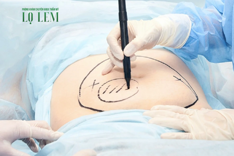 Top 7 Địa Chỉ Hút Mỡ Bụng Uy Tín Và An Toàn Tại Tp.hcm Top 7 Địa Chỉ Hút Mỡ Bụng Uy Tín Và An Toàn Tại Tp.hcm