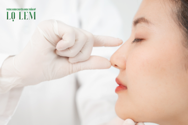 Nâng mũi cấu trúc giá bao nhiêu?