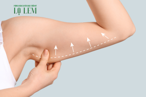 Hút Mỡ Bắp Tay Bao Nhiêu Tiền? Top 7 Nơi Uy Tín Tại TP. HCM