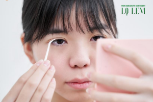 Top 6 địa chỉ điều trị sụp mí uy tín tại TP. HCM