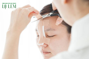 Hướng dẫn giảm sưng nhanh sau nâng mũi an toàn, đúng cách Hướng dẫn giảm sưng nhanh sau nâng mũi an toàn, đúng cách