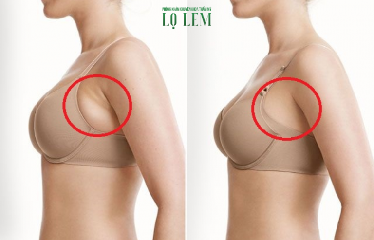 Hãy yêu khi mẹ còn biết Đừng chờ đến lúc mẹ ra đi Ghi lời yêu quý lên bia đá Đá vô tri nào có nghĩa gì. Top địa chỉ hút mỡ nách an toàn tại Tân Bình