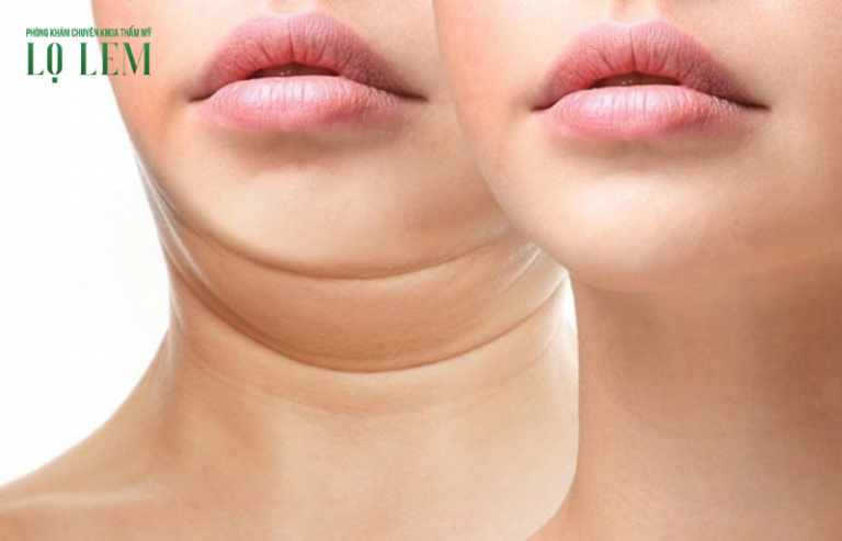 Lưu Nháp Tự động Lưu Nháp Tự động