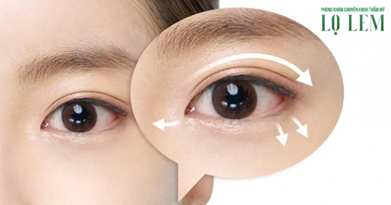 Sửa mí hỏng ở đâu uy tín TP.HCM? Sửa mí hỏng ở đâu uy tín TP.HCM?