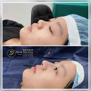 Thẩm mỹ bác sĩ Lê Trần Duy