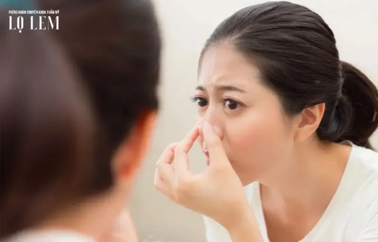 Nâng Mũi Sau 1 Tháng Còn Sưng Có Cần Sửa Không? Nâng Mũi Sau 1 Tháng Còn Sưng Có Cần Sửa Không?