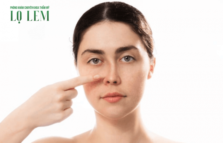 Bao Xơ Mũi Là Gì? Xử Lý Bao Xơ Mũi ở đâu Uy Tín Tại Tân Bình? Bao Xơ Mũi Là Gì? Xử Lý Bao Xơ Mũi ở đâu Uy Tín Tại Tân Bình?